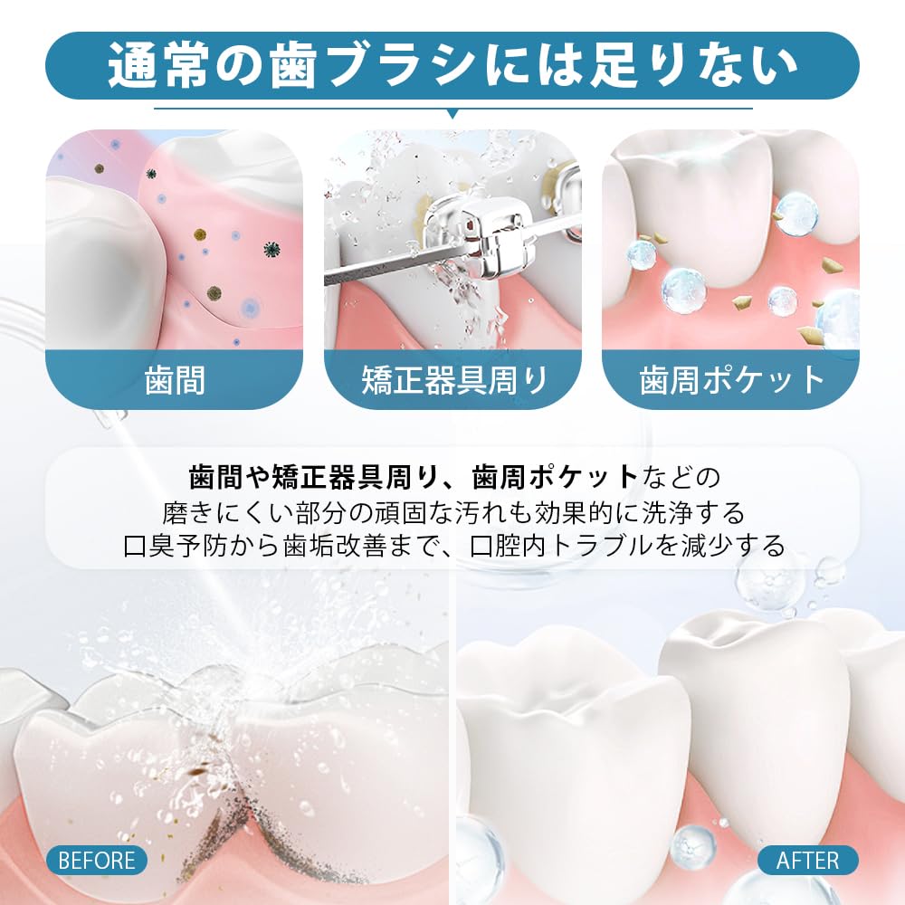 Amazon.co.jp: SONCCI ジェットウォッシャー 口腔洗浄器 しかん洗浄機